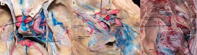 Blood Supply of Cranial Nerves Passing Through the Cavernous Sinus: An Anatomical Study and Its Implications for Microsurgical and Endoscopic Cavernous Sinus Surgery